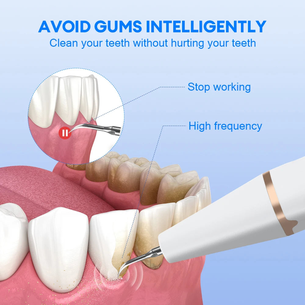 Smile Ultrasonic Tooth Scaler