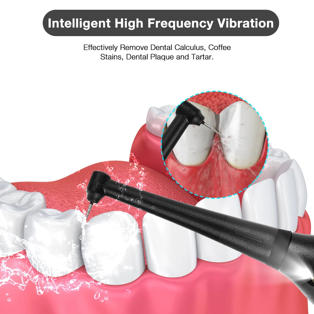 Smile Pro Ultrasonic Tooth Scaler