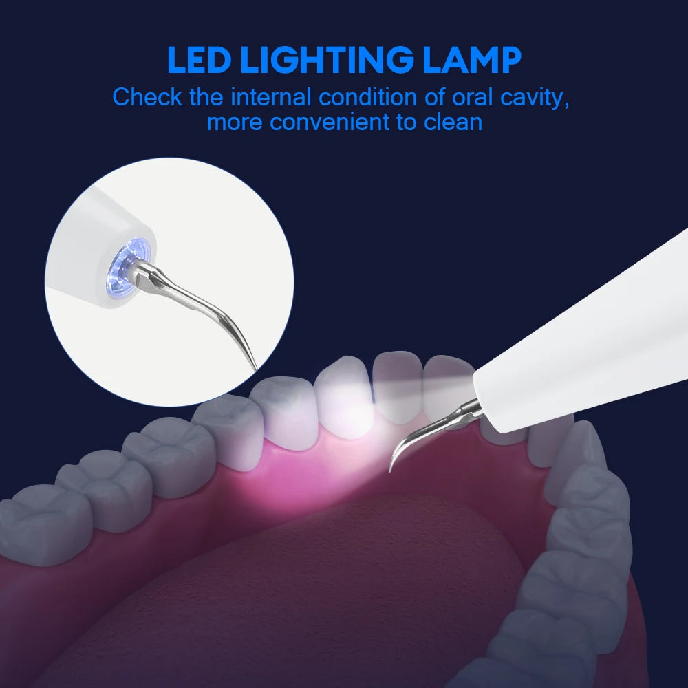 Smile Ultrasonic Tooth Scaler *Best Seller*