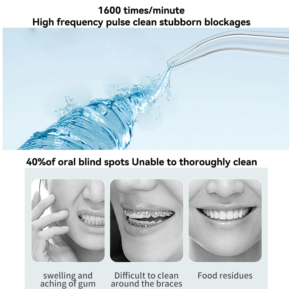 Smile Basic Water Flosser