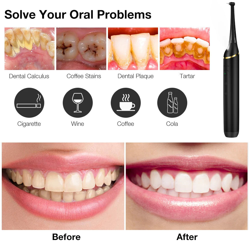Pro Ultrasonic Scaler